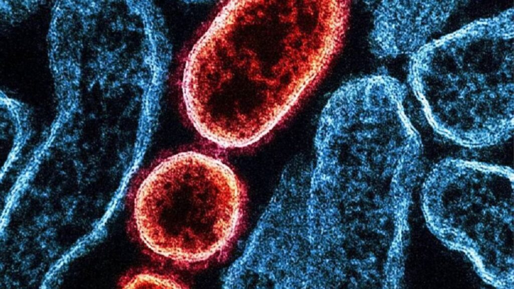 Virus Nipah dall'India, come si trasmette?