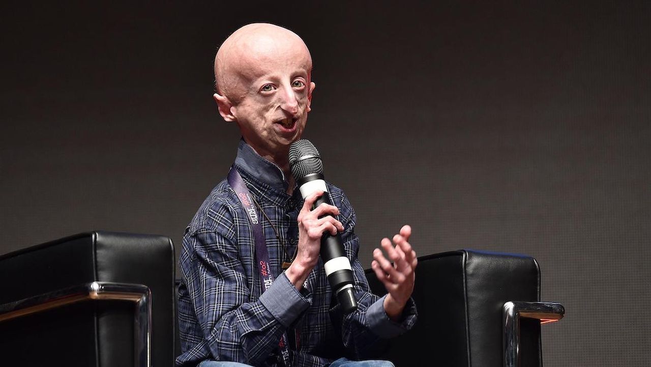 Chi era Sammy Basso, l’attivista scomparso a 28 anni a causa della Progeria