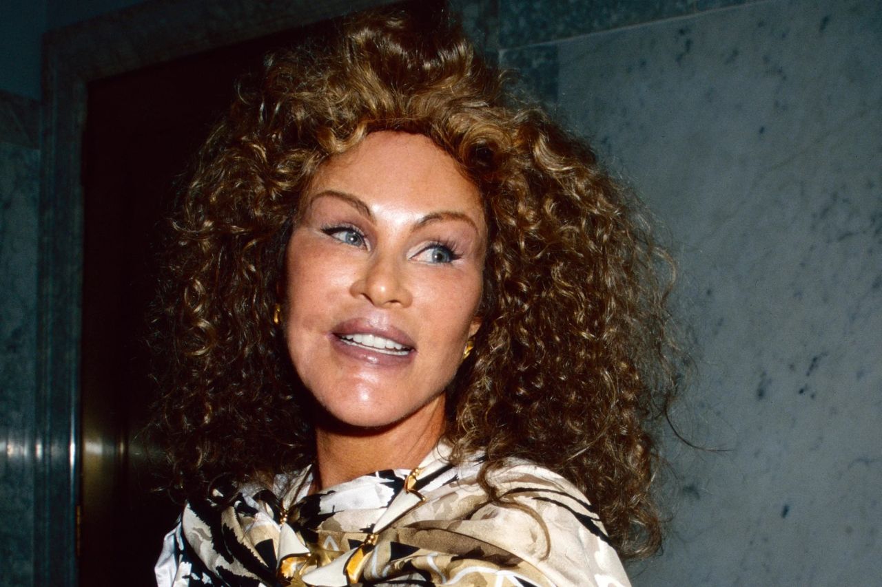 Chi era Jocelyn Wildenstein e perché era soprannominata Catwoman?