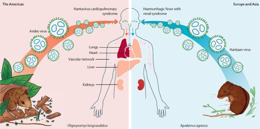 hantavirus