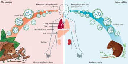 hantavirus