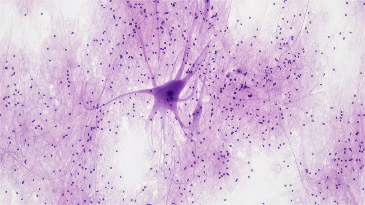 cellule neurologiche