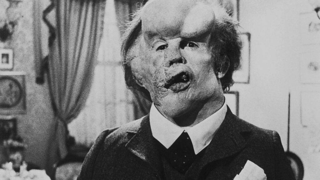 John Hurt interpreta "The Elephant Man" nell'omonimo film di David Lynch del 1980