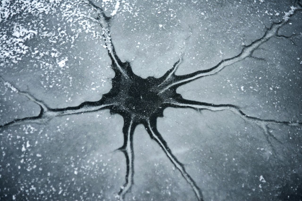 una cellula nervosa
