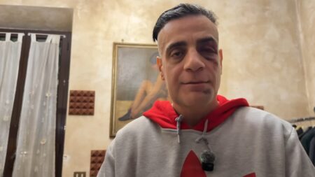 Simone Cicalone dopo l'aggressione