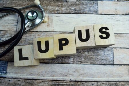 Svolta nello studio del lupus: è connesso al virus della malattia dei baci Cubi di legno che formano la parola Lupus