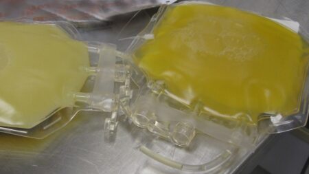 Due sacche di plasma